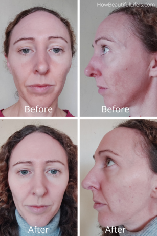 I used Eurcerin's Anti-Pigment Thiamidol skin care range for 12 weeks and here is what happened